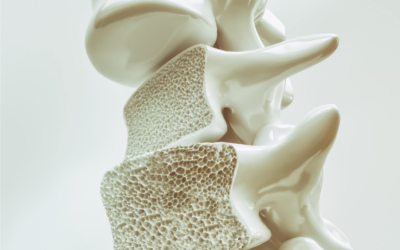 Glossaire : ostéoporose (pathologie, traitements, nutrition)